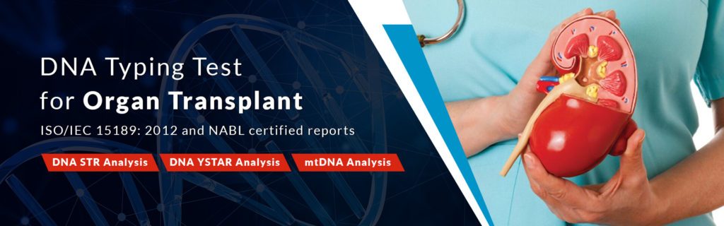 Kidney Organ Transplant DNA Test