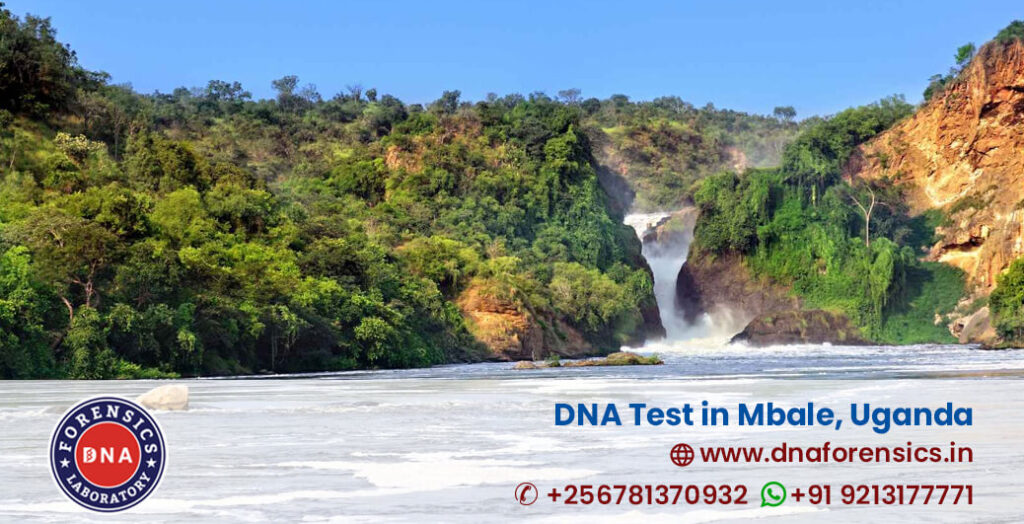 DNA Test in Mbale DNA Test Cost in Mbale