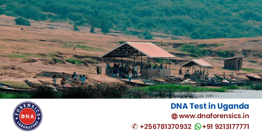 DNA Test in Uganda | Paternity DNA Test Price in Uganda