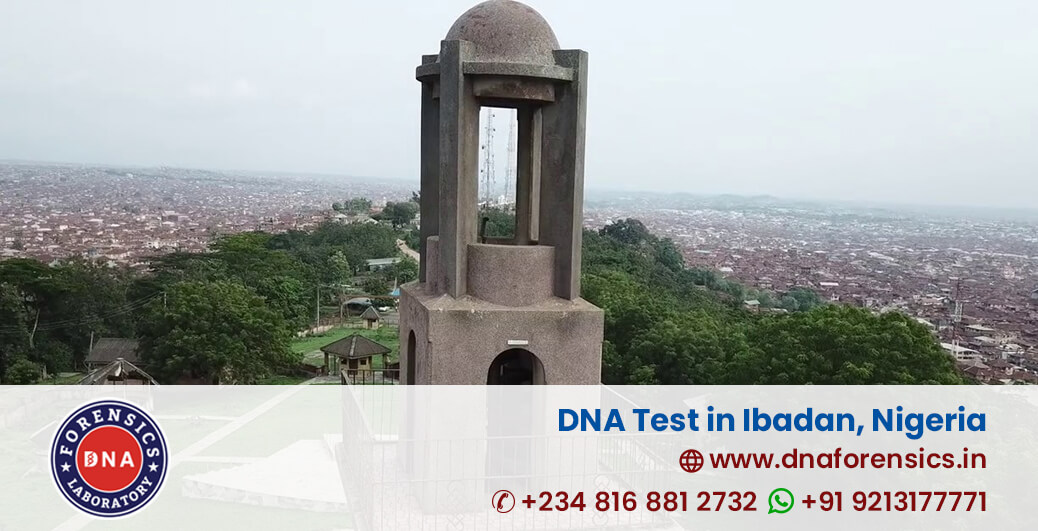 DNA Test in Ibadan