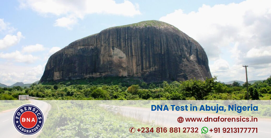 DNA Test in Abuja