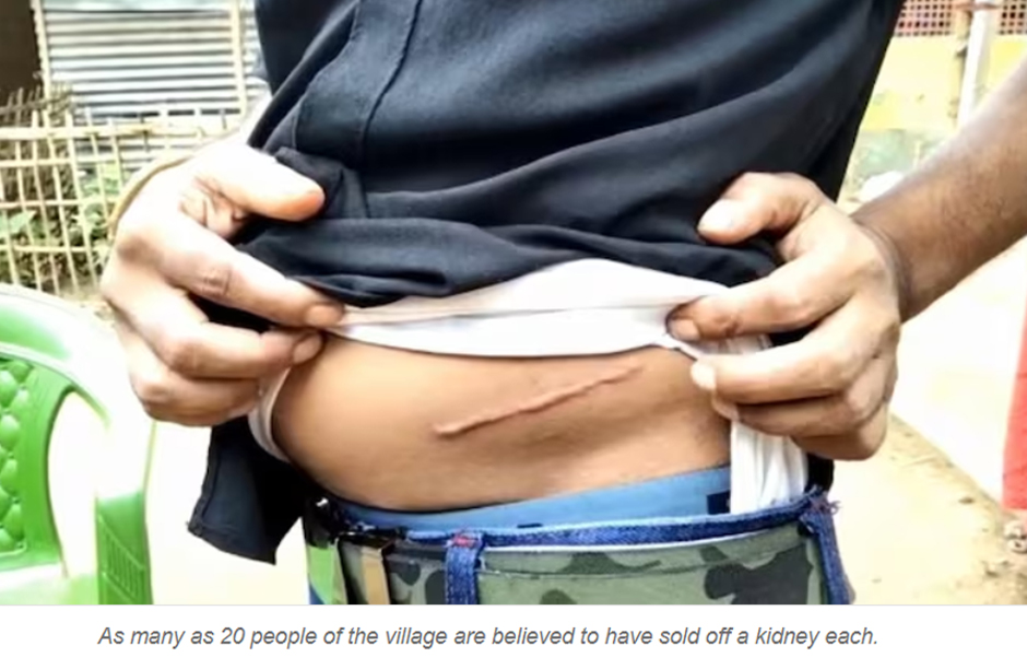 Assam's Organ Trafficking Scandal